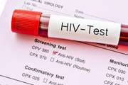 انجام ۶۰۰ تست محرمانه و رایگان، طی پویش ملی HIV در شهرستان دزفول 